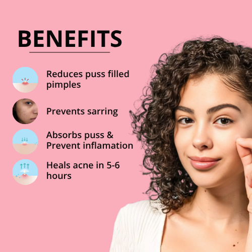 Acne Pimple Patches